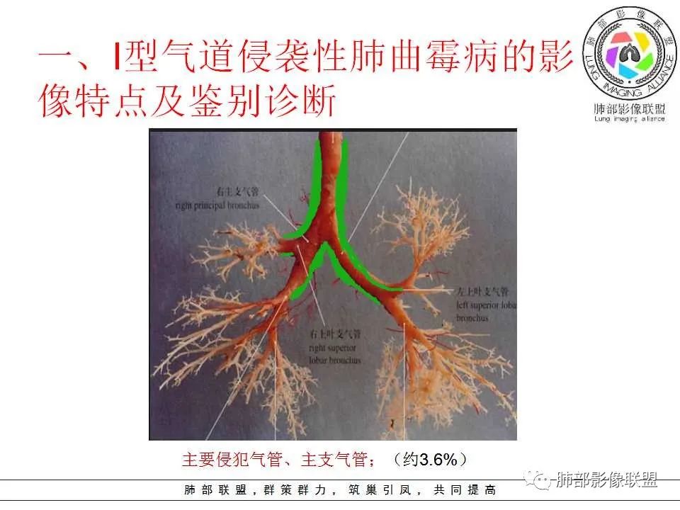 【PPT】侵袭性肺曲霉病影像分型及表现 【PPT】侵袭性肺曲霉病影像分型及表现