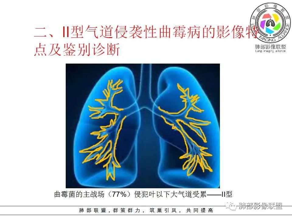 【PPT】侵袭性肺曲霉病影像分型及表现 【PPT】侵袭性肺曲霉病影像分型及表现
