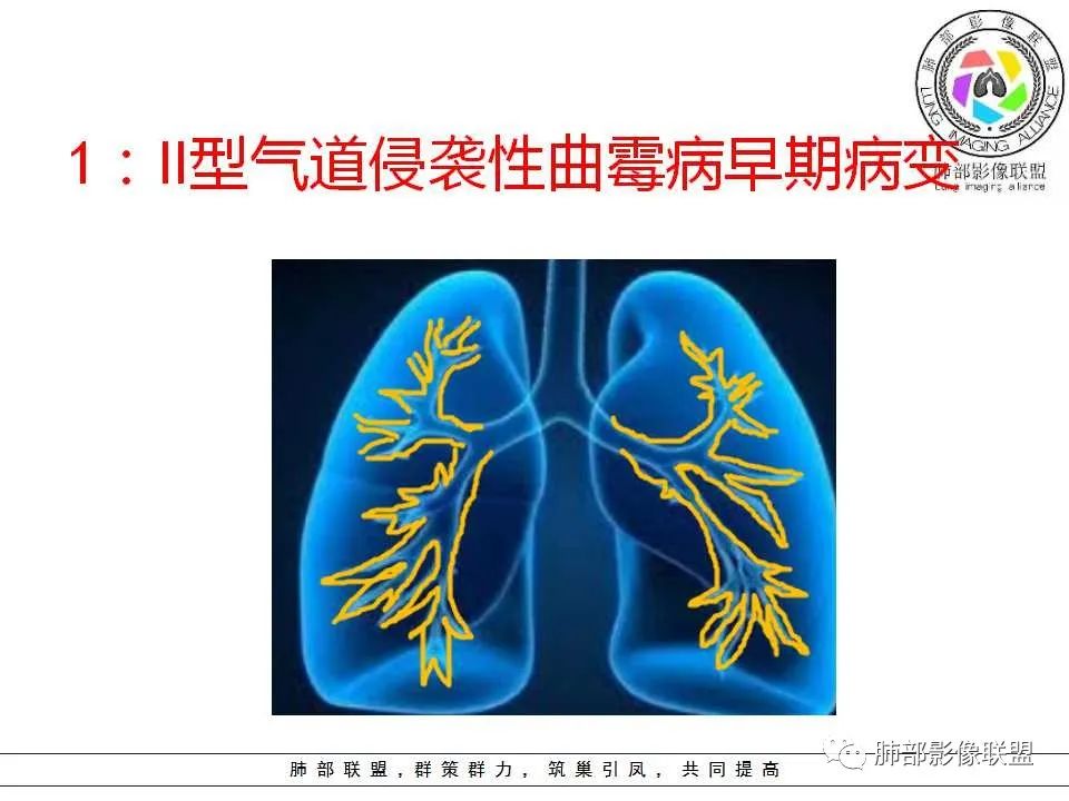 【PPT】侵袭性肺曲霉病影像分型及表现 【PPT】侵袭性肺曲霉病影像分型及表现