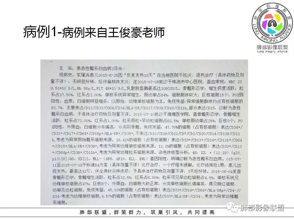【PPT】侵袭性肺曲霉病影像分型及表现 【PPT】侵袭性肺曲霉病影像分型及表现