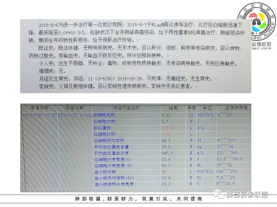 【PPT】侵袭性肺曲霉病影像分型及表现 【PPT】侵袭性肺曲霉病影像分型及表现