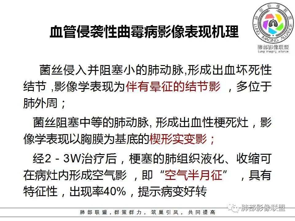 【PPT】侵袭性肺曲霉病影像分型及表现 【PPT】侵袭性肺曲霉病影像分型及表现