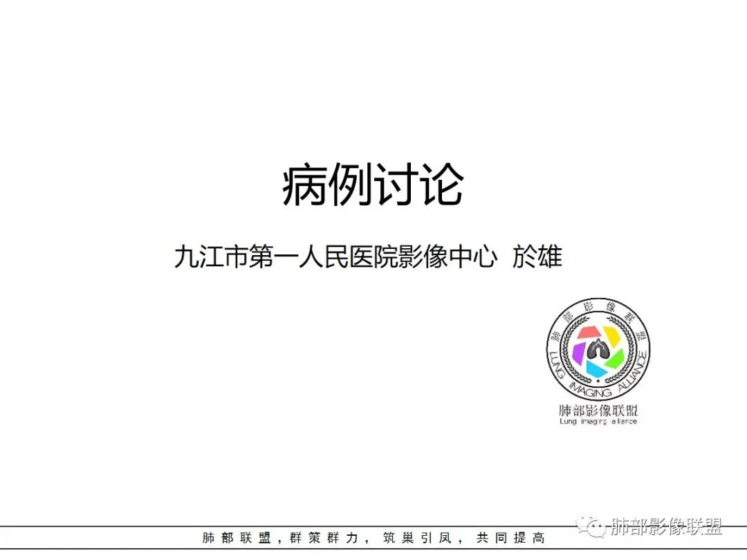 【病例】让人琢磨不透的肺肿块—肺癌1例CT影像 【病例】让人琢磨不透的肺肿块—肺癌1例CT影像