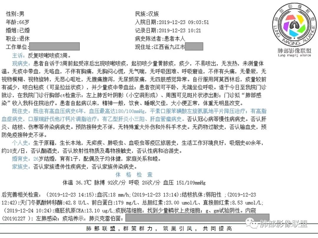 【病例】让人琢磨不透的肺肿块—肺癌1例CT影像 【病例】让人琢磨不透的肺肿块—肺癌1例CT影像
