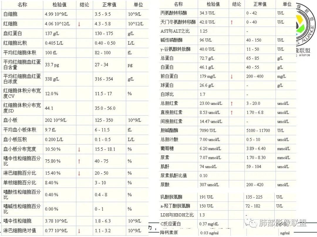 【病例】让人琢磨不透的肺肿块—肺癌1例CT影像 【病例】让人琢磨不透的肺肿块—肺癌1例CT影像
