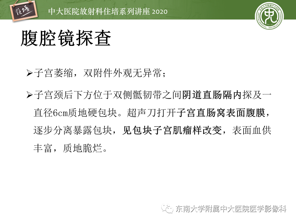 【PPT】女性盆腔实性占位性病变定位分析