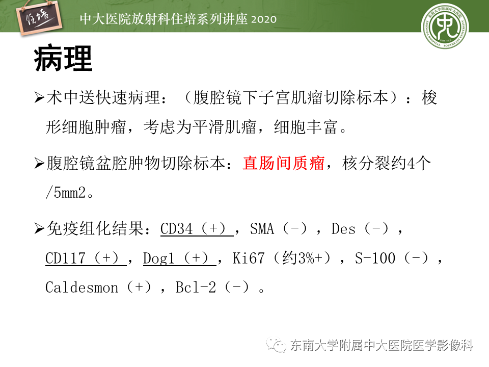 【PPT】女性盆腔实性占位性病变定位分析