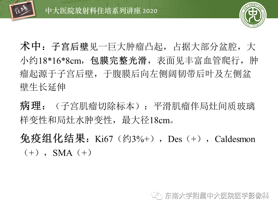 【PPT】女性盆腔实性占位性病变定位分析