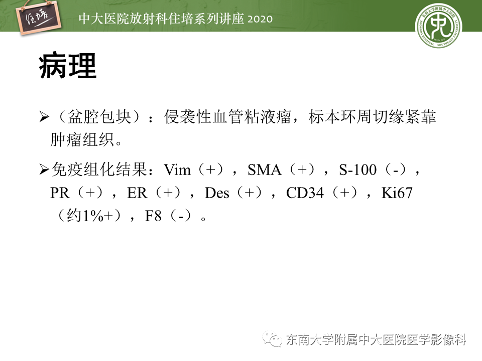 【PPT】女性盆腔实性占位性病变定位分析
