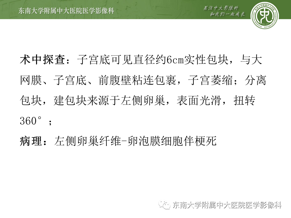 【PPT】女性盆腔实性占位性病变定位分析