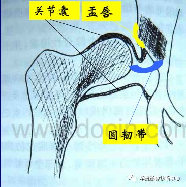 先天性髋关节脱位