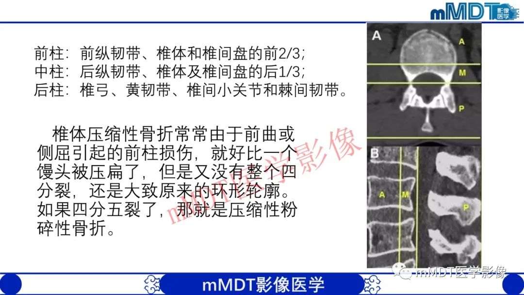 【PPT】从椎体形态判断疾病