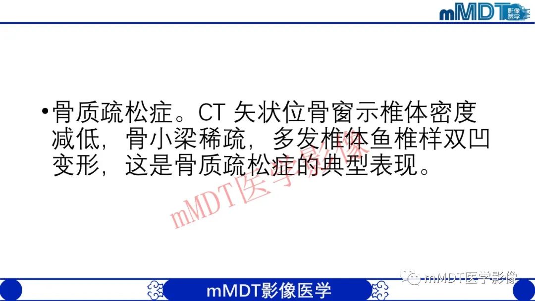 【PPT】从椎体形态判断疾病