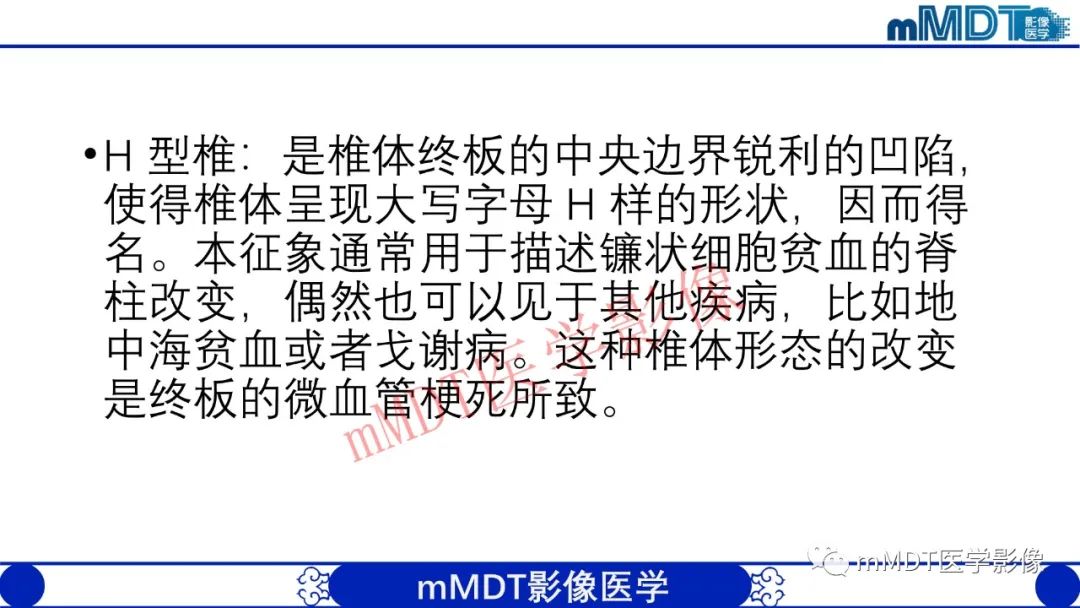 【PPT】从椎体形态判断疾病
