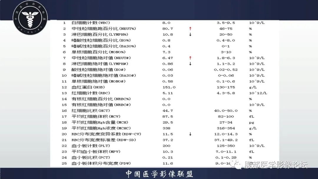 【病例】脾脏弥漫性大B细胞淋巴瘤1例MR影像讨论 【病例】脾脏弥漫性大B细胞淋巴瘤1例MR影像讨论