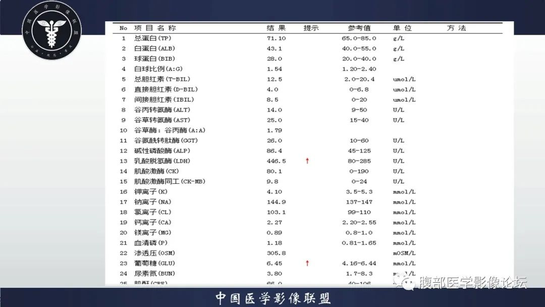 【病例】脾脏弥漫性大B细胞淋巴瘤1例MR影像讨论 【病例】脾脏弥漫性大B细胞淋巴瘤1例MR影像讨论