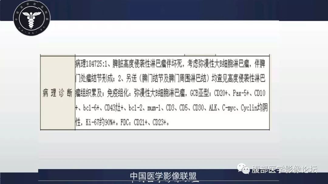 【病例】脾脏弥漫性大B细胞淋巴瘤1例MR影像讨论 【病例】脾脏弥漫性大B细胞淋巴瘤1例MR影像讨论