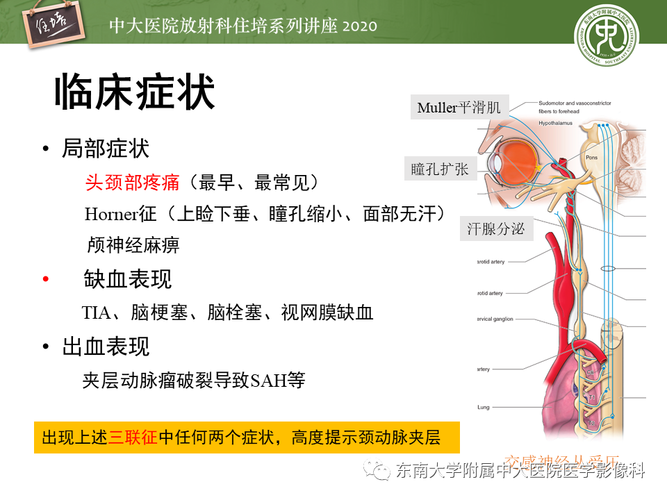 【PPT】颈动脉夹层及夹层动脉瘤的影像诊断及评估