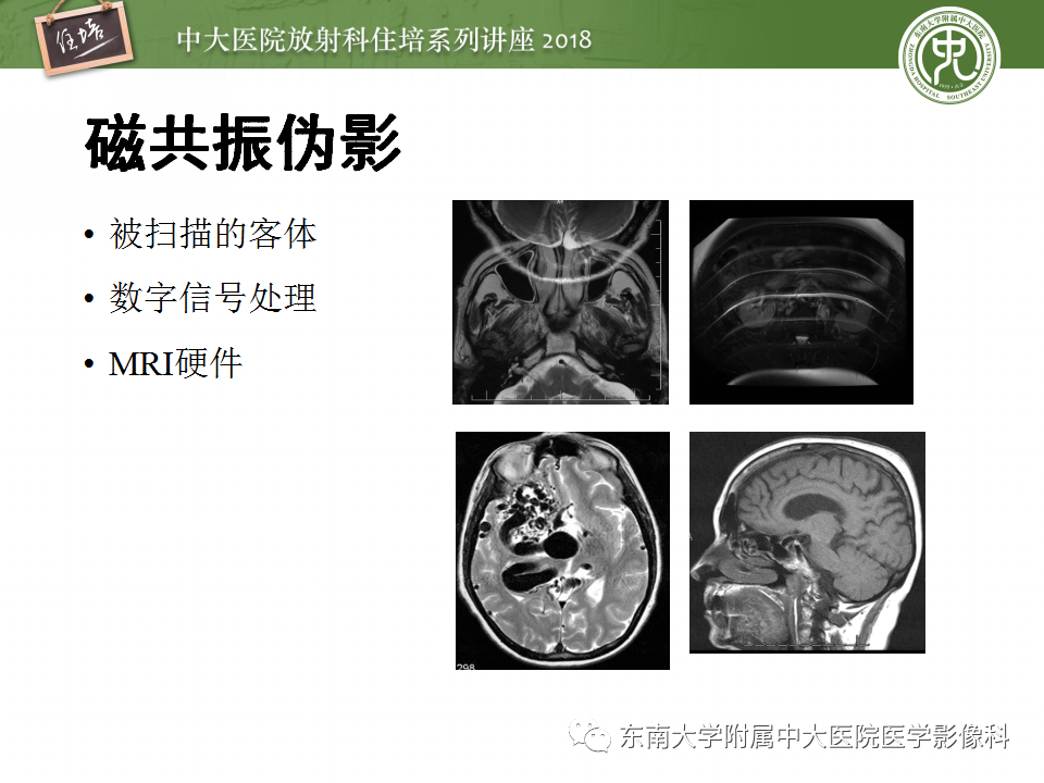 【PPT】磁共振成像常见伪影