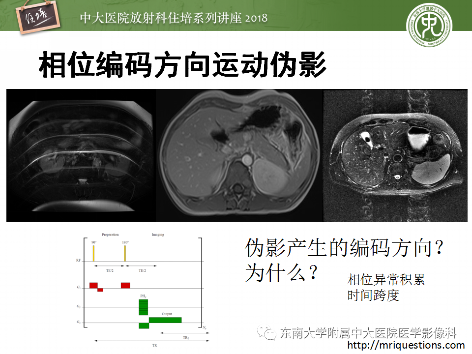 【PPT】磁共振成像常见伪影