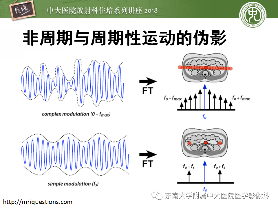 【PPT】磁共振成像常见伪影