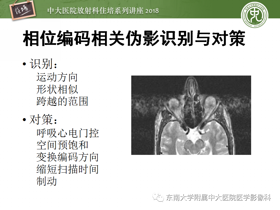 【PPT】磁共振成像常见伪影