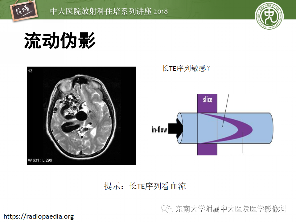 【PPT】磁共振成像常见伪影