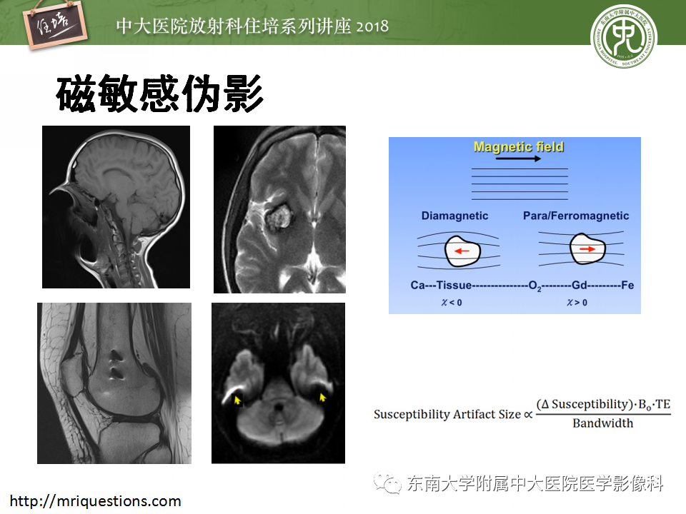 【PPT】磁共振成像常见伪影