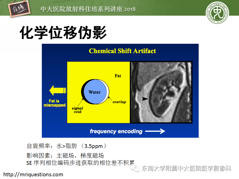 【PPT】磁共振成像常见伪影