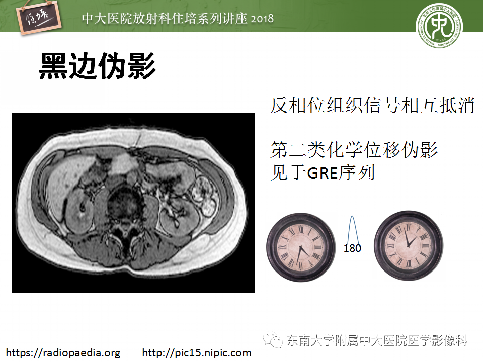 【PPT】磁共振成像常见伪影