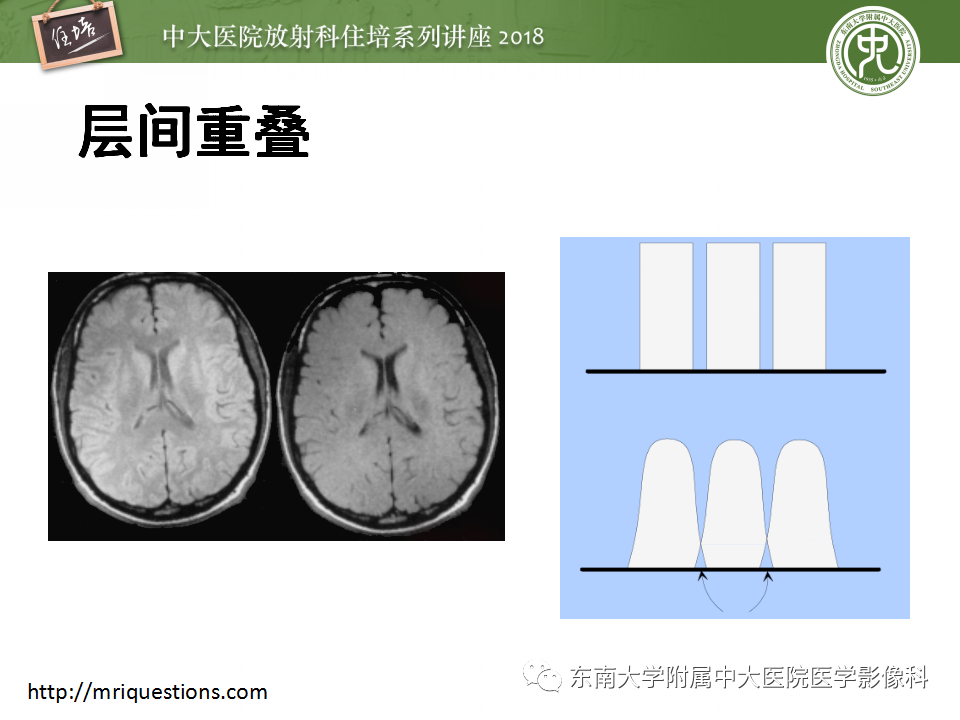 【PPT】磁共振成像常见伪影