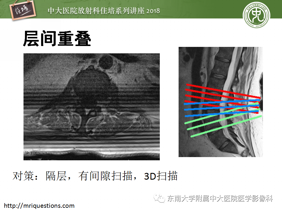 【PPT】磁共振成像常见伪影