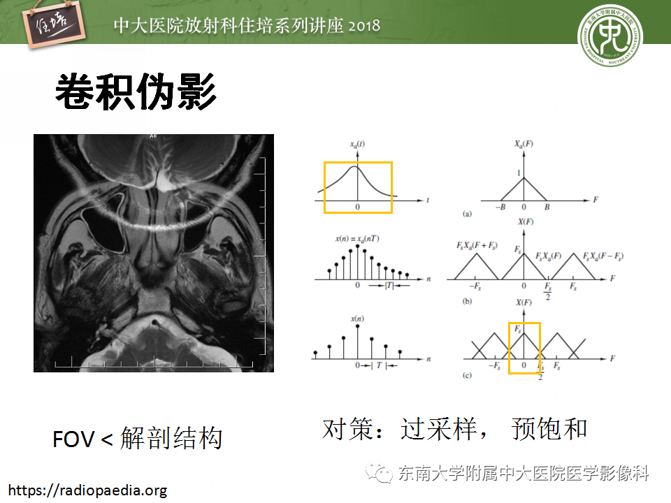 【PPT】磁共振成像常见伪影