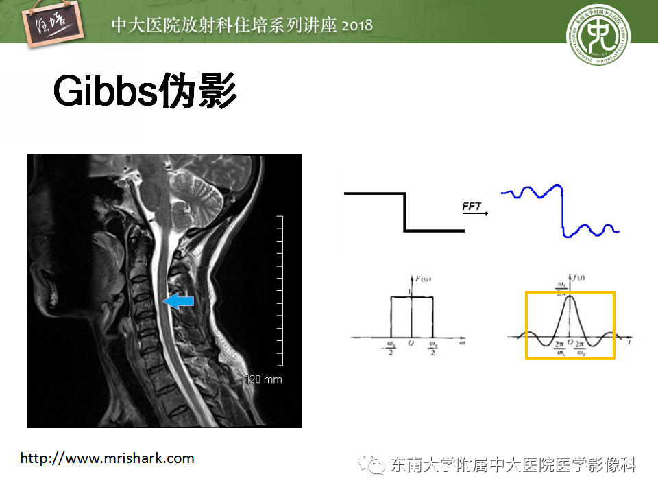 【PPT】磁共振成像常见伪影
