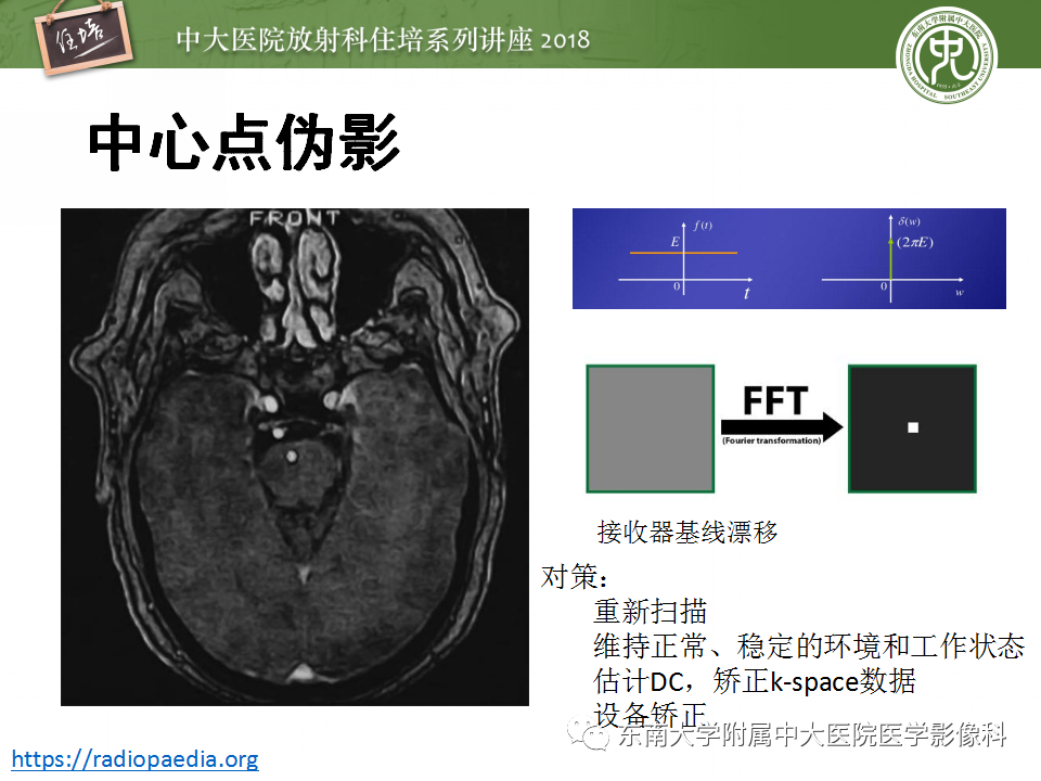 【PPT】磁共振成像常见伪影