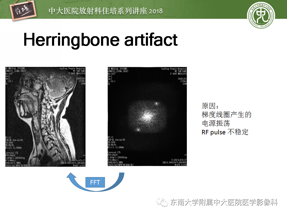 【PPT】磁共振成像常见伪影
