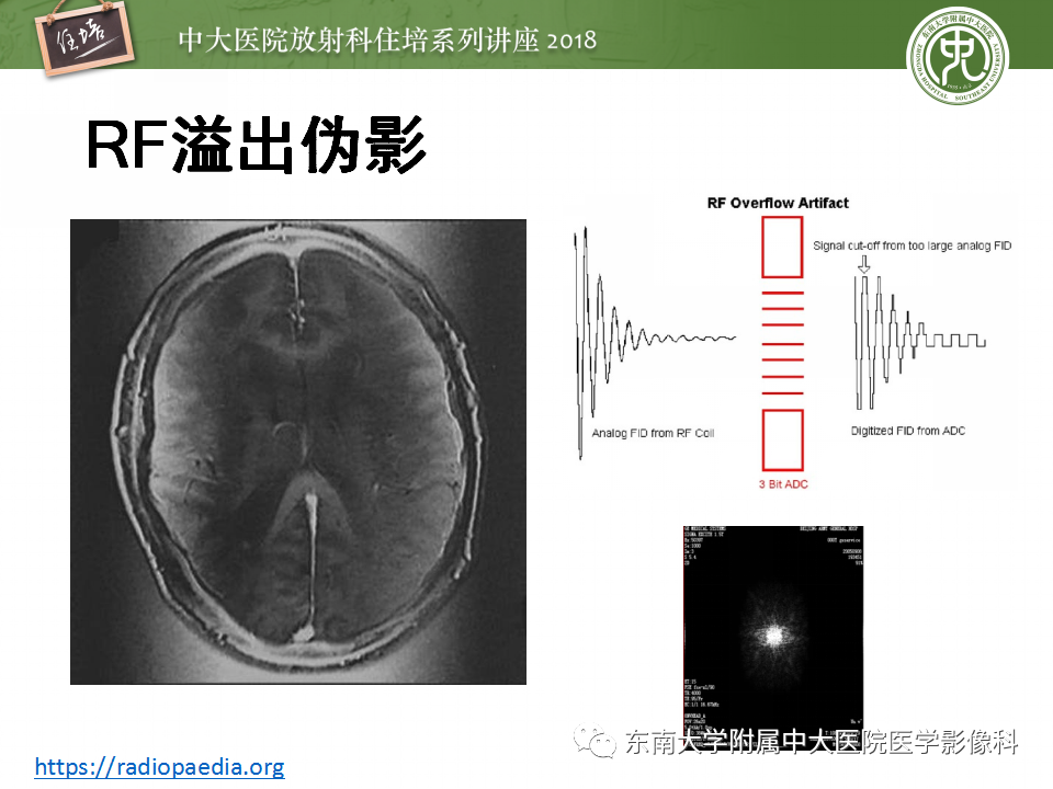 【PPT】磁共振成像常见伪影
