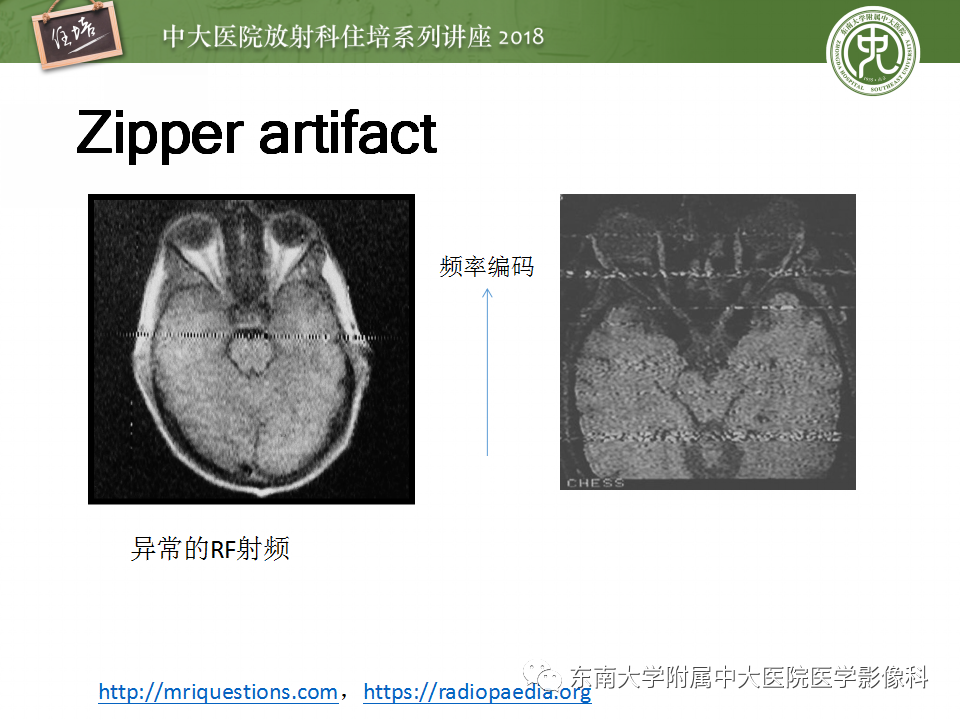 【PPT】磁共振成像常见伪影