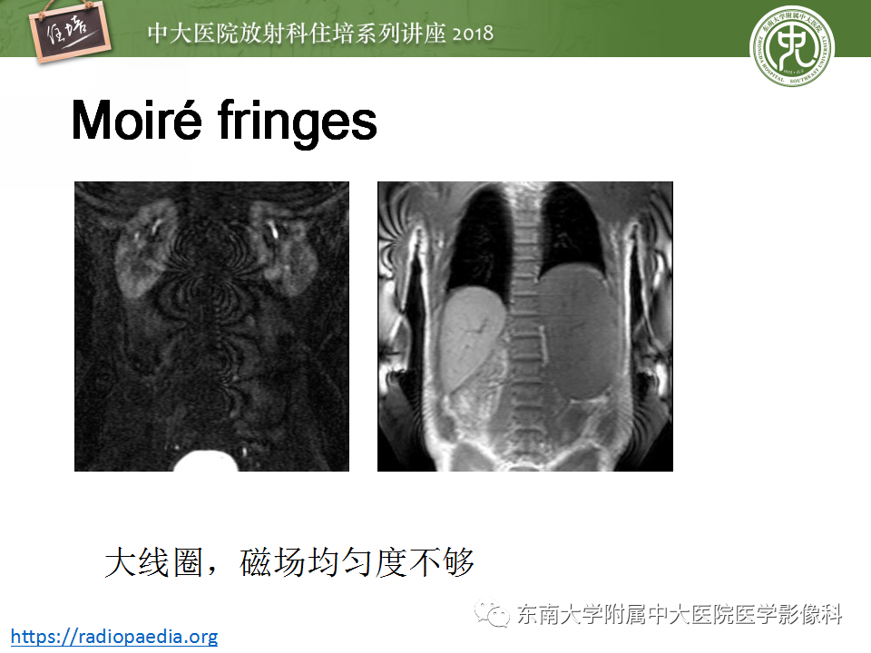 【PPT】磁共振成像常见伪影