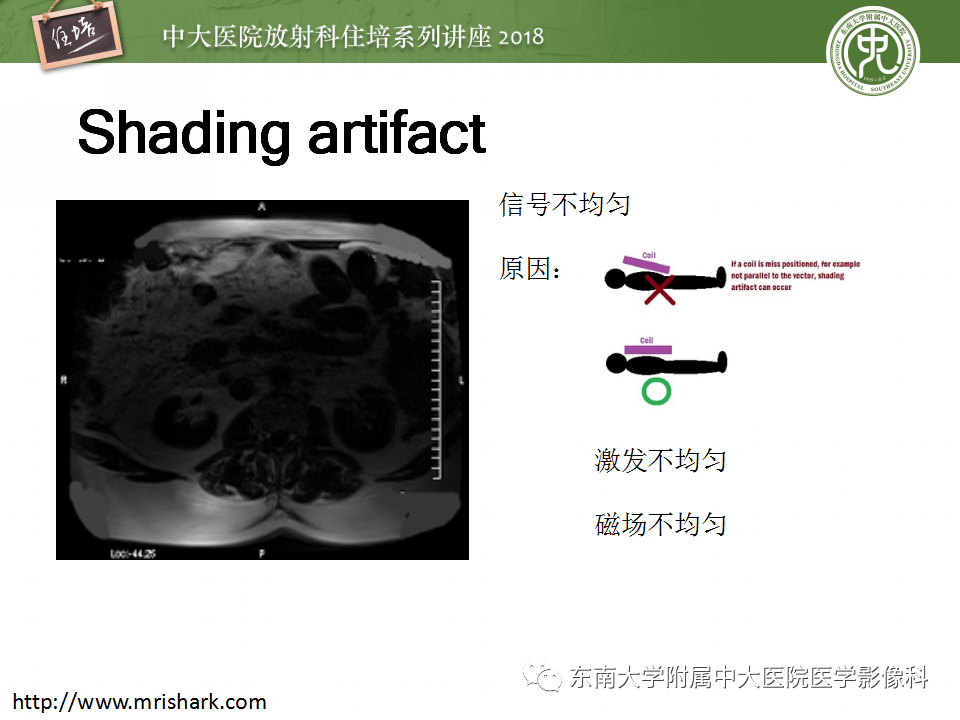 【PPT】磁共振成像常见伪影