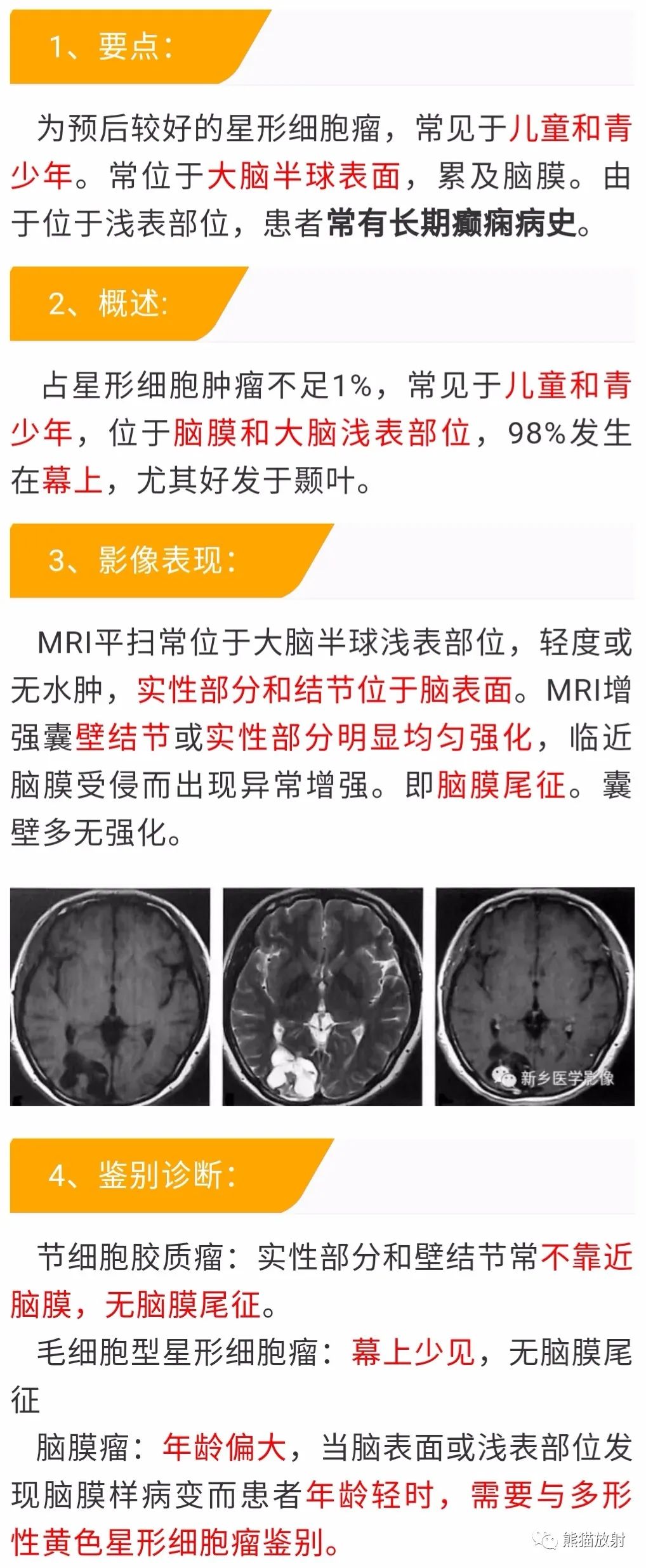 【病例】多形性黄色星形细胞瘤1例MR影像 【病例】多形性黄色星形细胞瘤1例MR影像