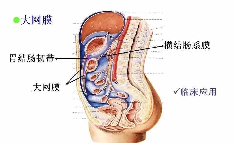 腹腔局灶性脂肪坏死的典型影像学征象及其鉴别诊断 腹腔局灶性脂肪坏死的典型影像学征象及其鉴别诊断