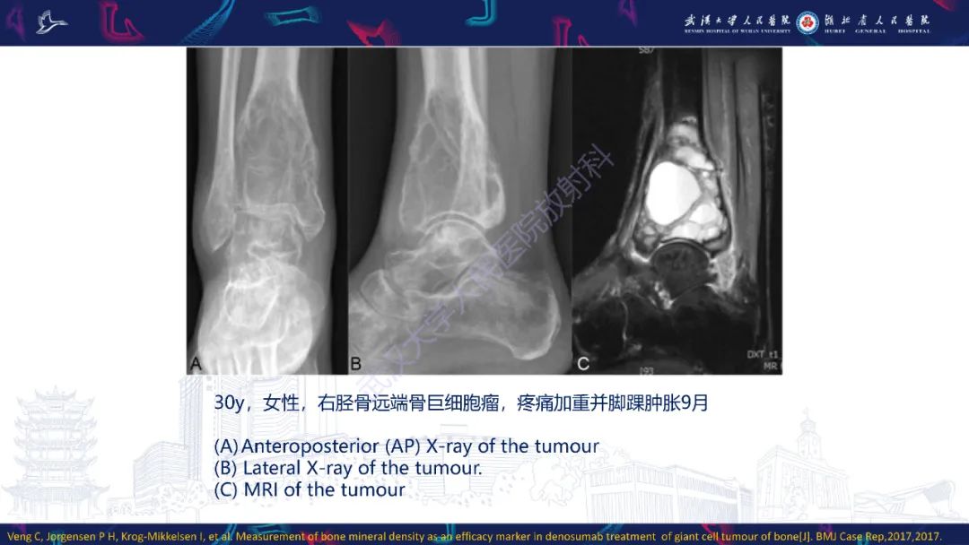 【PPT】