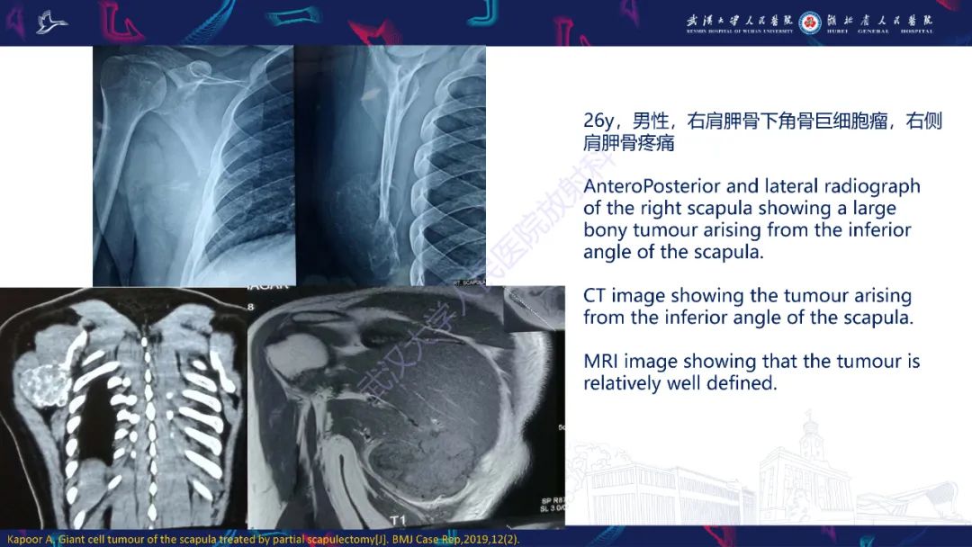 【PPT】