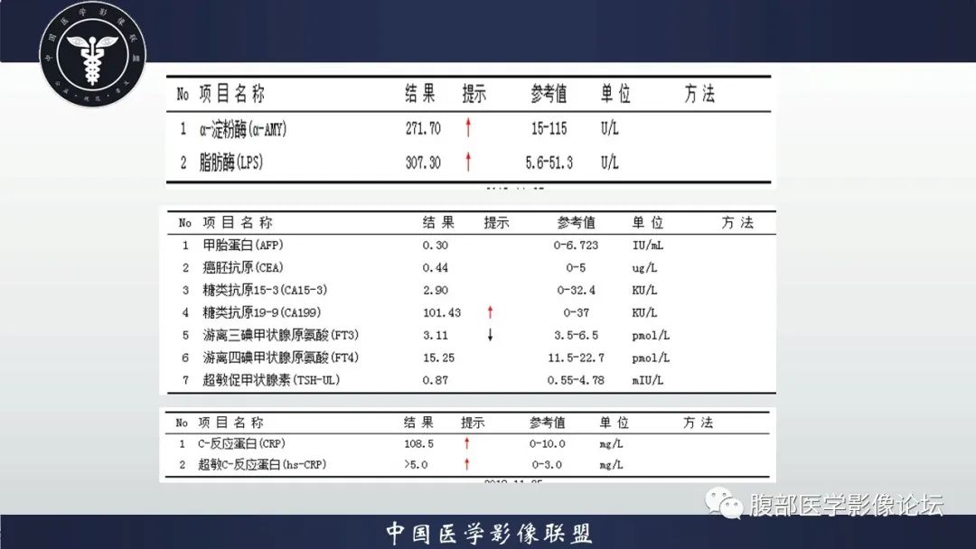 【病例】神经内分泌肿瘤伴肝转移1例CT影像讨论 【病例】神经内分泌肿瘤伴肝转移1例CT影像讨论