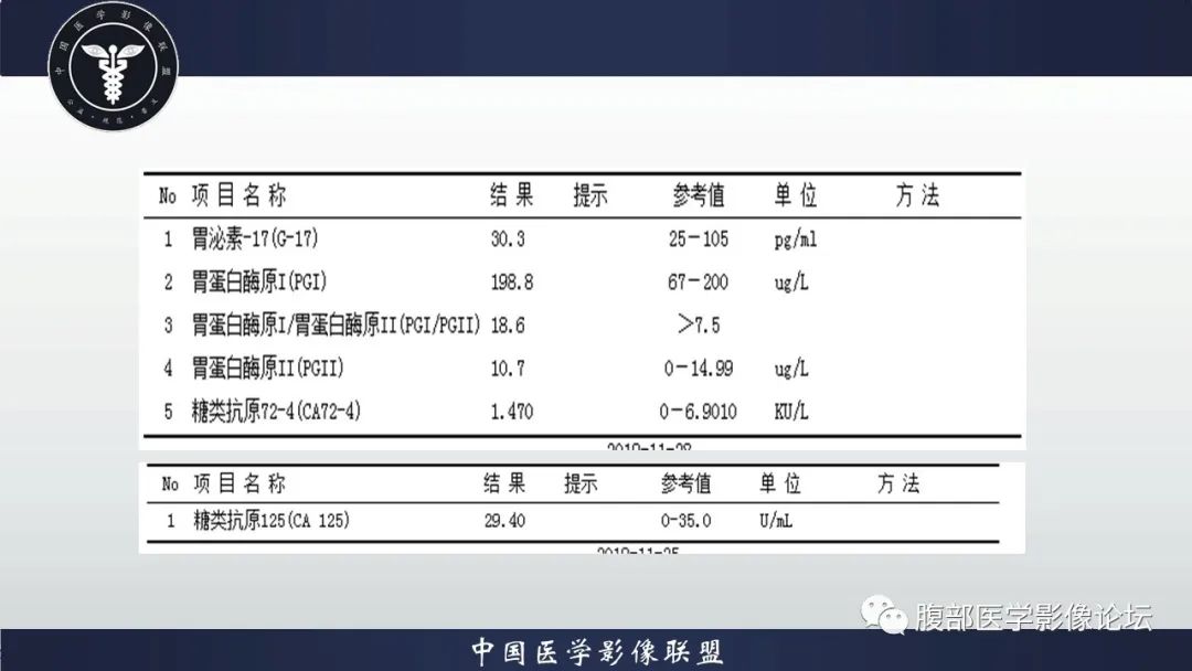 【病例】神经内分泌肿瘤伴肝转移1例CT影像讨论 【病例】神经内分泌肿瘤伴肝转移1例CT影像讨论
