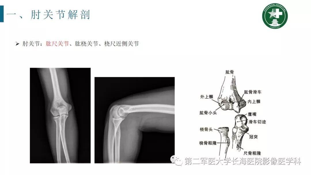 【PPT】肘关节运动损伤MR诊断