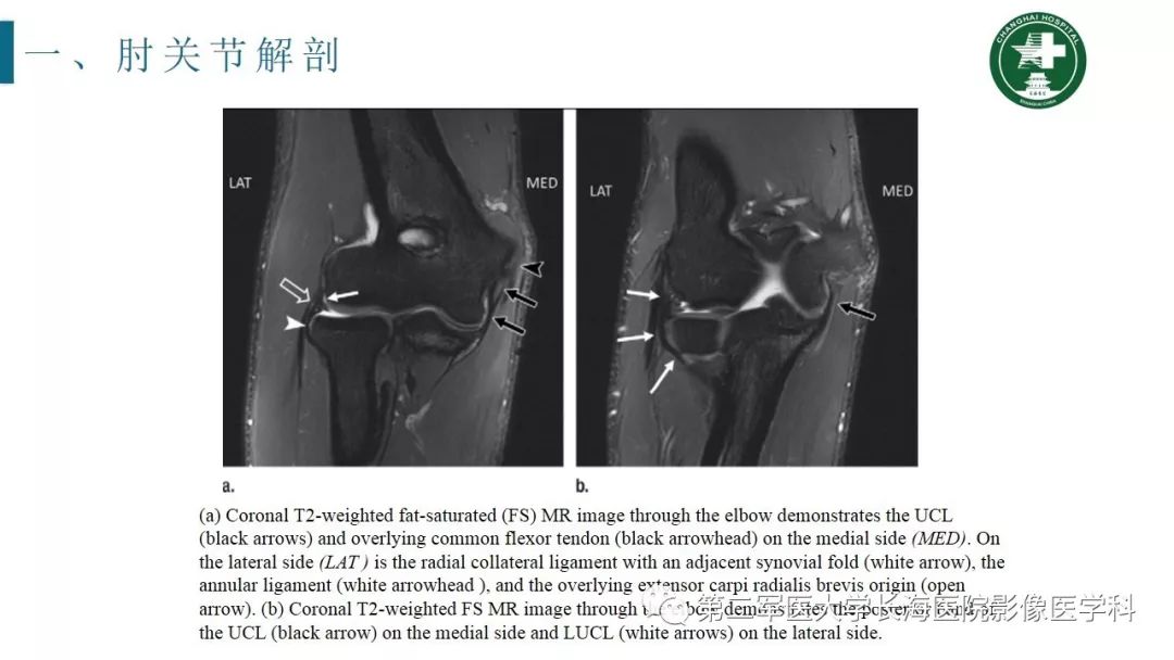 【PPT】肘关节运动损伤MR诊断