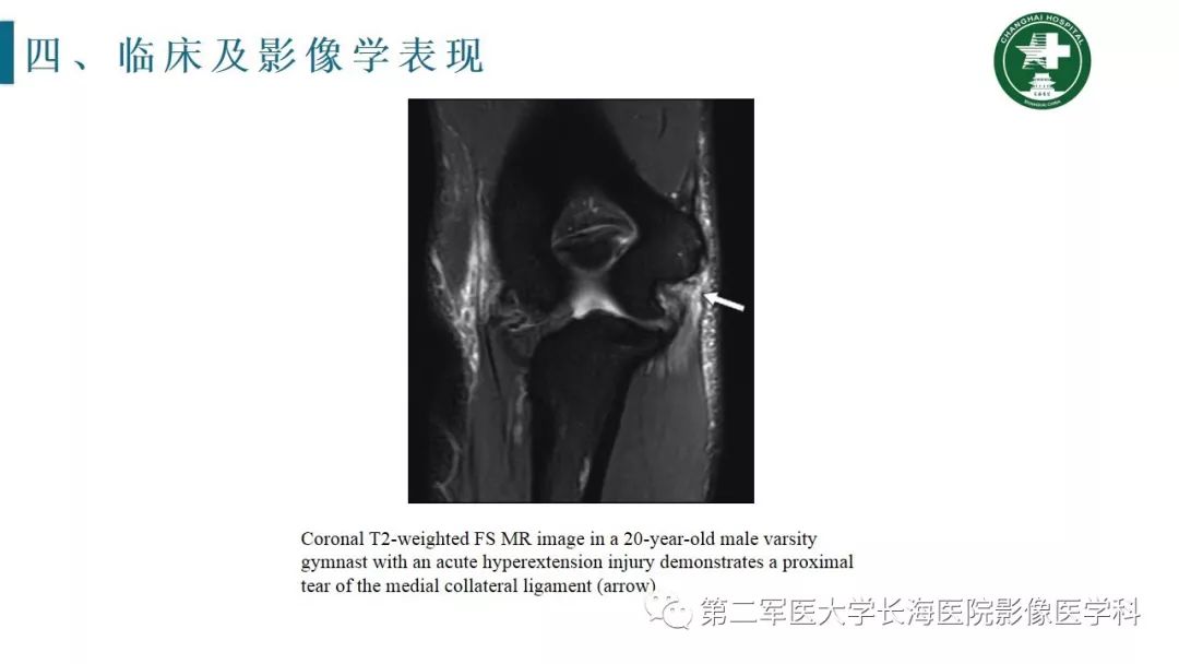 【PPT】肘关节运动损伤MR诊断