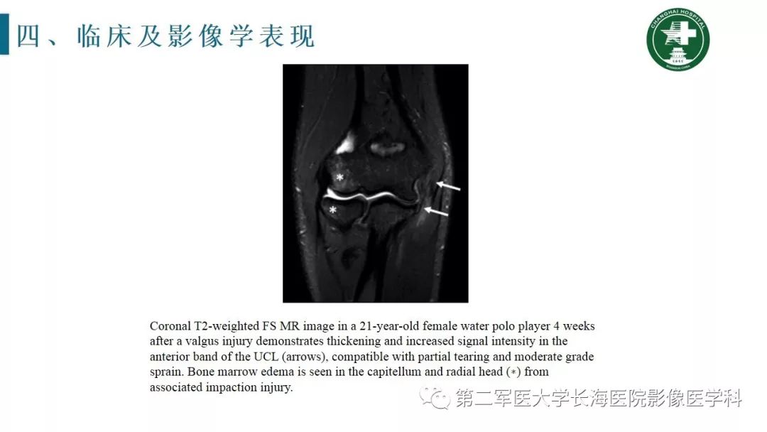 【PPT】肘关节运动损伤MR诊断
